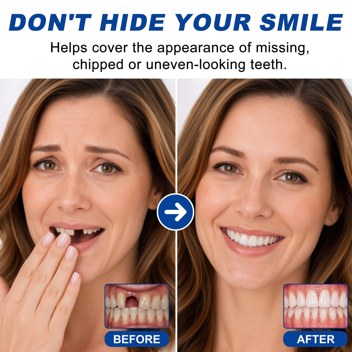 Moldable False Teeth G548838